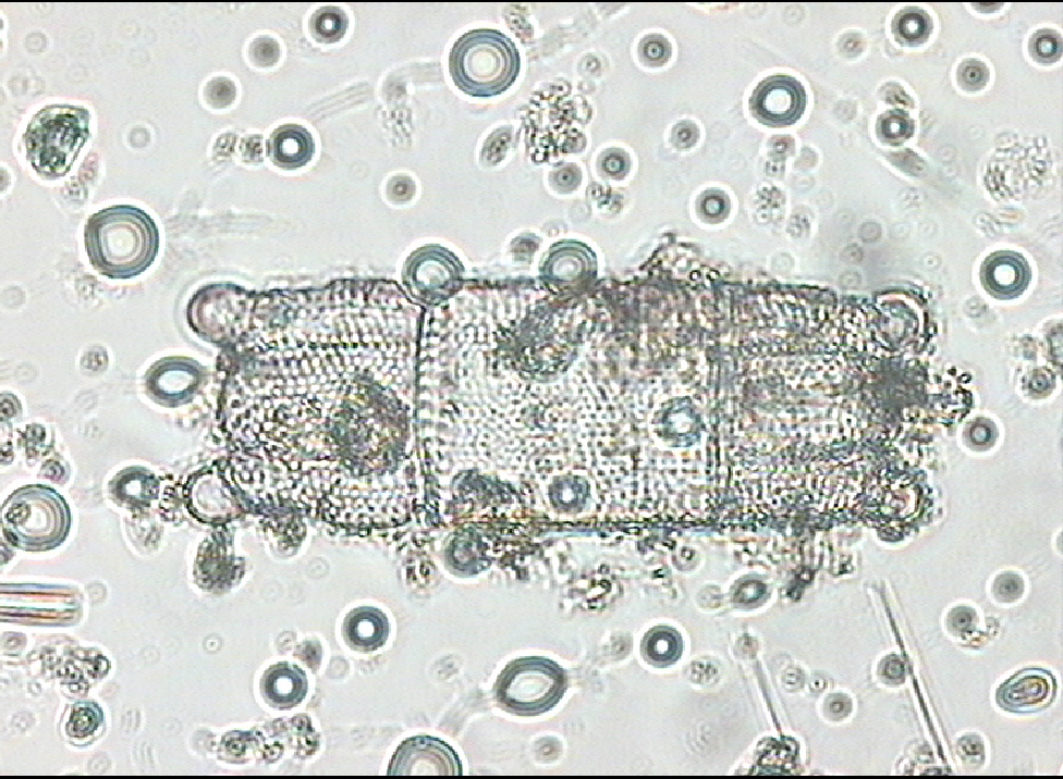 Dictyocha speculum